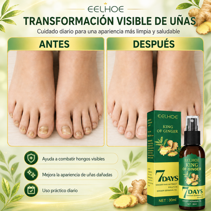 ¡2x1! 7Days Fungus Free Nails® | Protege y elimina el hongo de tus Uñas