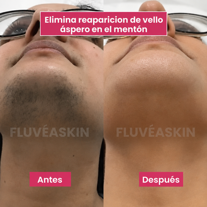 Cyperus Rotundus Oil 60 ml- Aceite Depilación Definitiva