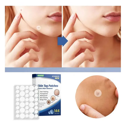 Parches Anti Verrugas Patch – Tratamiento Discreto para Verrugas sin dolor