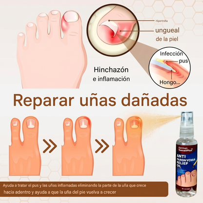 Super Promo 2x1 Spray Antihongos – Protección y cuidado para tus uñas