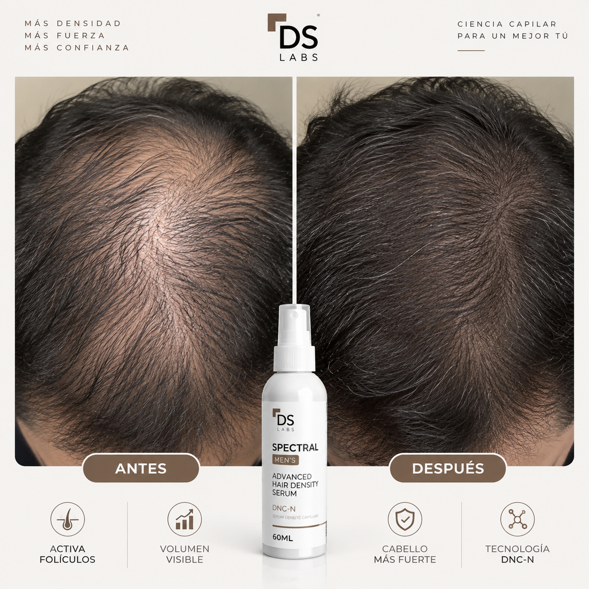 Spectral Men's (DNC-N) 60ML- Combate la alopecia y promueve el engrosamiento capilar