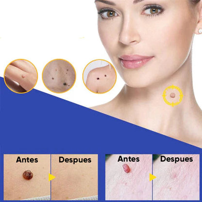 Parches Anti Verrugas Patch – Tratamiento Discreto para Verrugas sin dolor